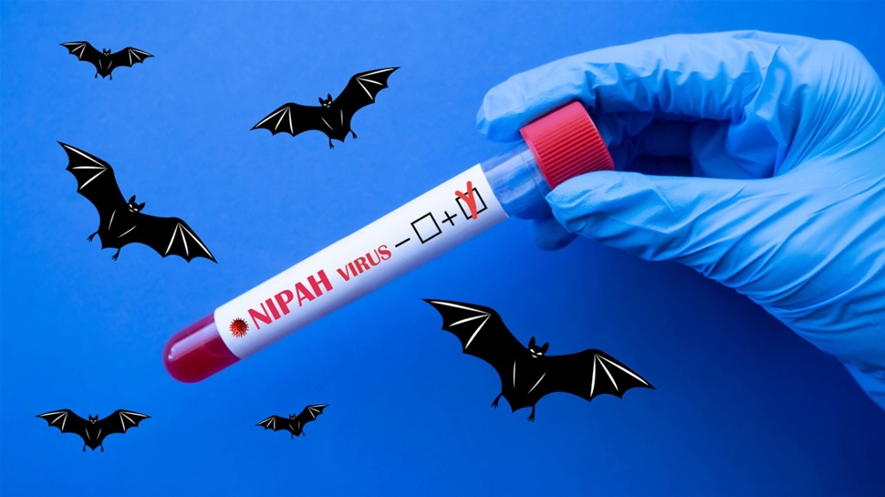 Vi-rút Nipah